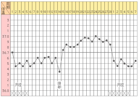 グラフ